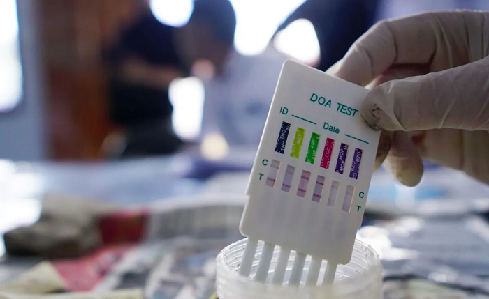 Ilustrasi tes urine. (ANTARA FOTO/Adiwinata Solihin)